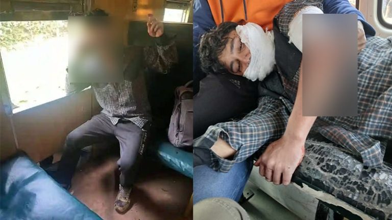 চট্টগ্রাম বিশ্ববিদ্যালয়ে শাটল ট্রেনে দুই শিক্ষার্থীকে ছুরিকাঘাত