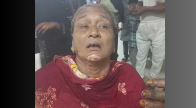বায়েজিদে চলন্ত সিএনজিতে পেট্রোল বোমা নিক্ষেপ, দগ্ধ দুই যাত্রী